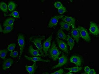 RHOH antibody