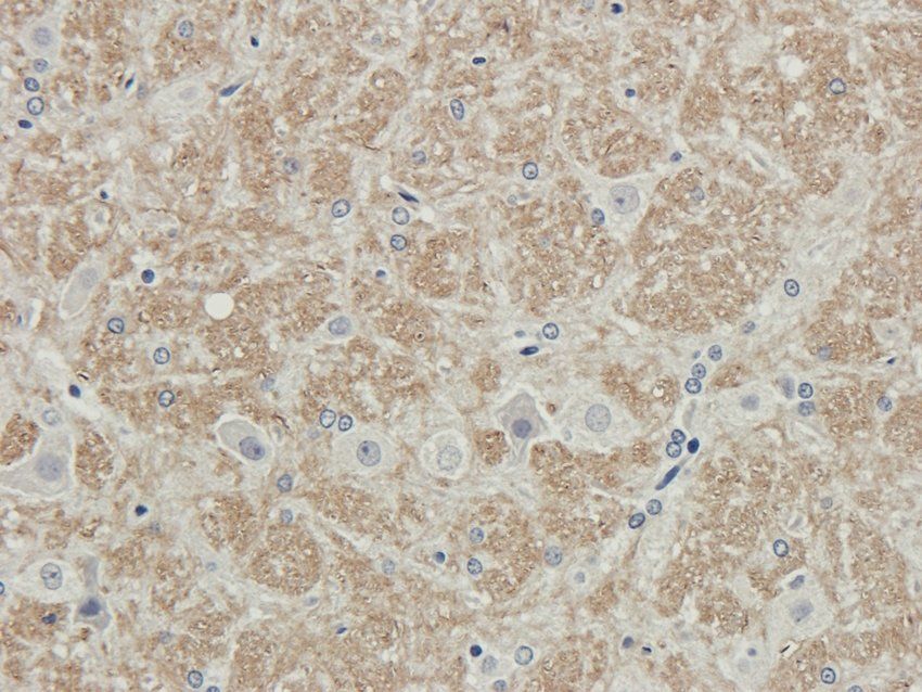 RHOT1 antibody