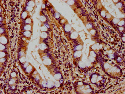 RHOT2 antibody