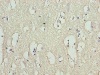 RHPN1-AS1 Antibody