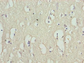 RHPN1-AS1 antibody