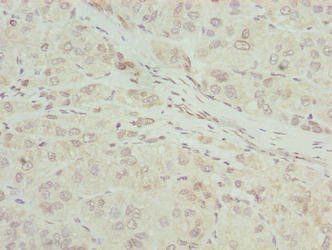 RIBC2 antibody