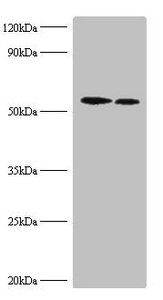 Ribosomal protein S6 kinase beta-2 antibody
