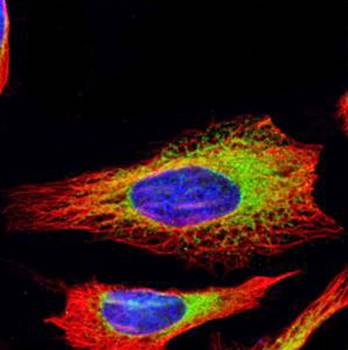 ribosome binding protein 1 antibody