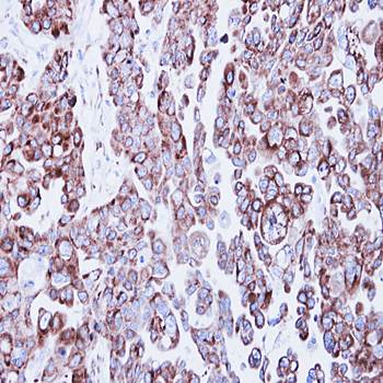 ribosome binding protein 1 antibody