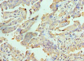 RICTOR Antibody