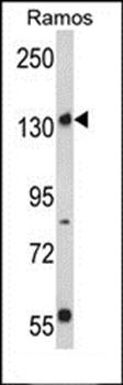 Rictor antibody