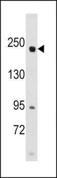 RICTOR antibody