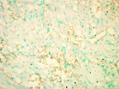 RICTOR antibody [C3], C-term