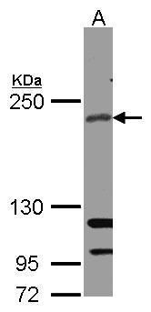 RICTOR antibody [C3], C-term