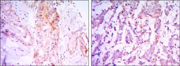 RICTOR Antibody