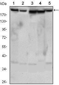 RICTOR Antibody