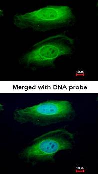 RICTOR antibody