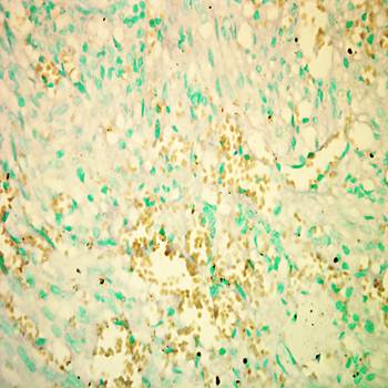 RICTOR antibody