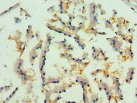 RIPK2 Antibody