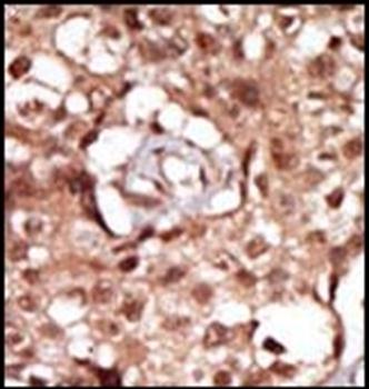 RIPK2 antibody
