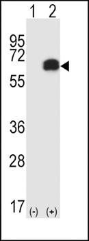 RIPK2 antibody