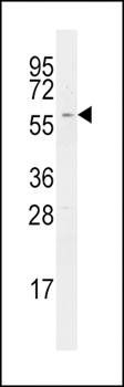 RIPK2 antibody