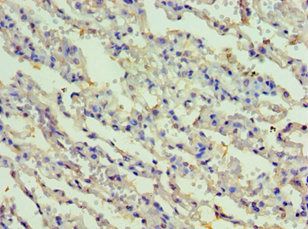 RIPK3 Antibody
