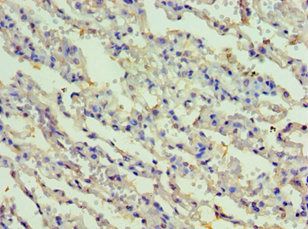 RIPK3 antibody