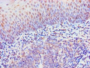 RIPK3 Antibody
