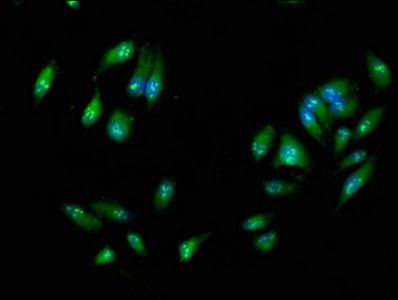 RIPK3 Antibody