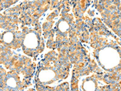 RIPK4 Antibody