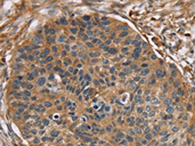 RIPK4 Antibody