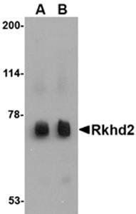 Rkhd2 Rabbit Polyclonal Antibody