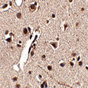 Rkhd4 Antibody