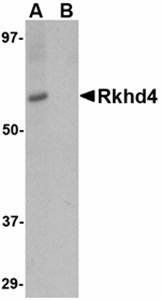 Rkhd4 Rabbit Polyclonal Antibody