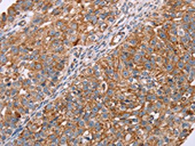 RMDN3 antibody