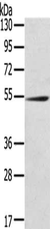RMDN3 antibody