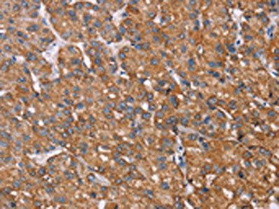 RMDN3 Antibody