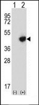 RMND5B antibody