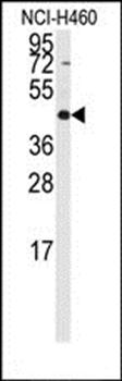 RMND5B antibody