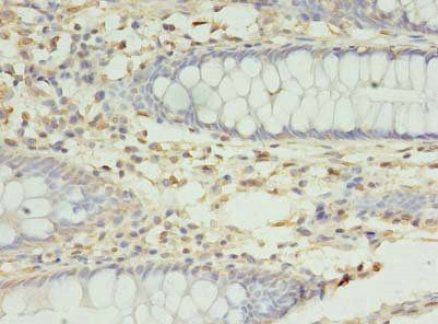 RMND5B Antibody