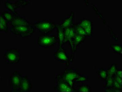 RNA-binding motif protein antibody