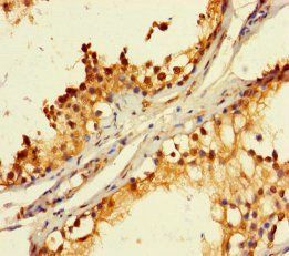 RBMY1A1 Antibody