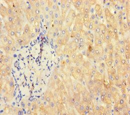 RBMY1A1 Antibody