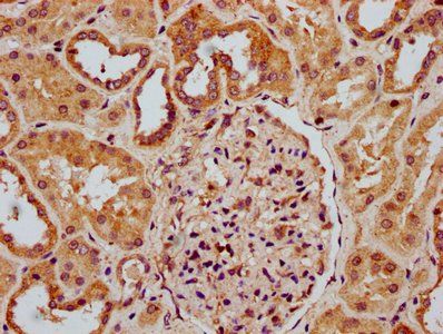 RNASEH1 Antibody