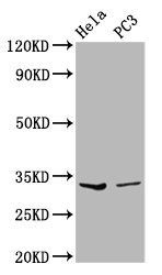RNASEH1 Antibody