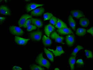 RND1 Antibody