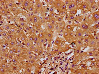 RND1 Antibody