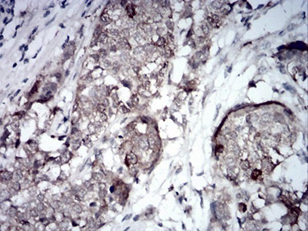 RND3 Antibody