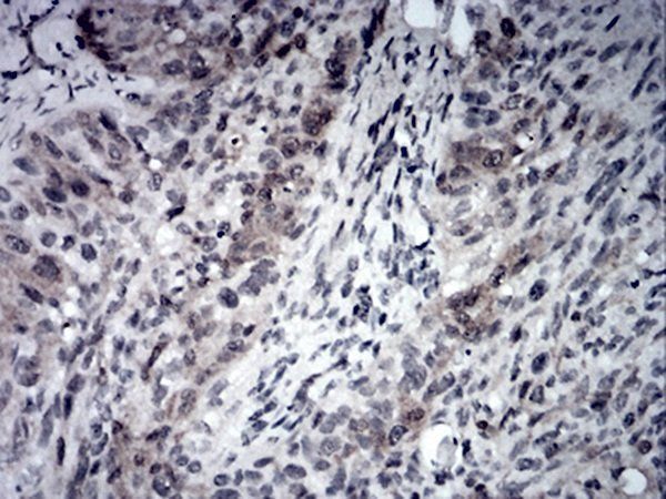 RND3 Antibody