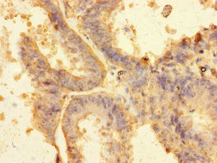 RNF103 Antibody