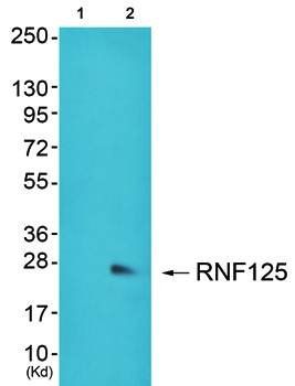 RNF125 Antibody