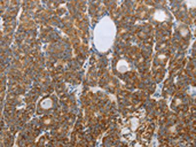 RNF126 Antibody
