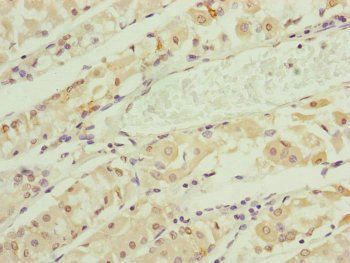 RNF135 Antibody